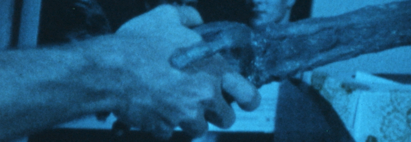 A person shaking hands with a cadaver.